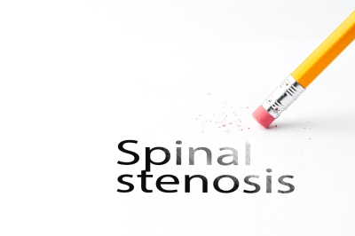 erasing spinal stenosis